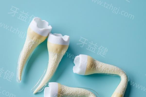 新版大連牙科的醫(yī)院全瓷牙價格一覽表 美容冠800-2000|聚合瓷全瓷牙500